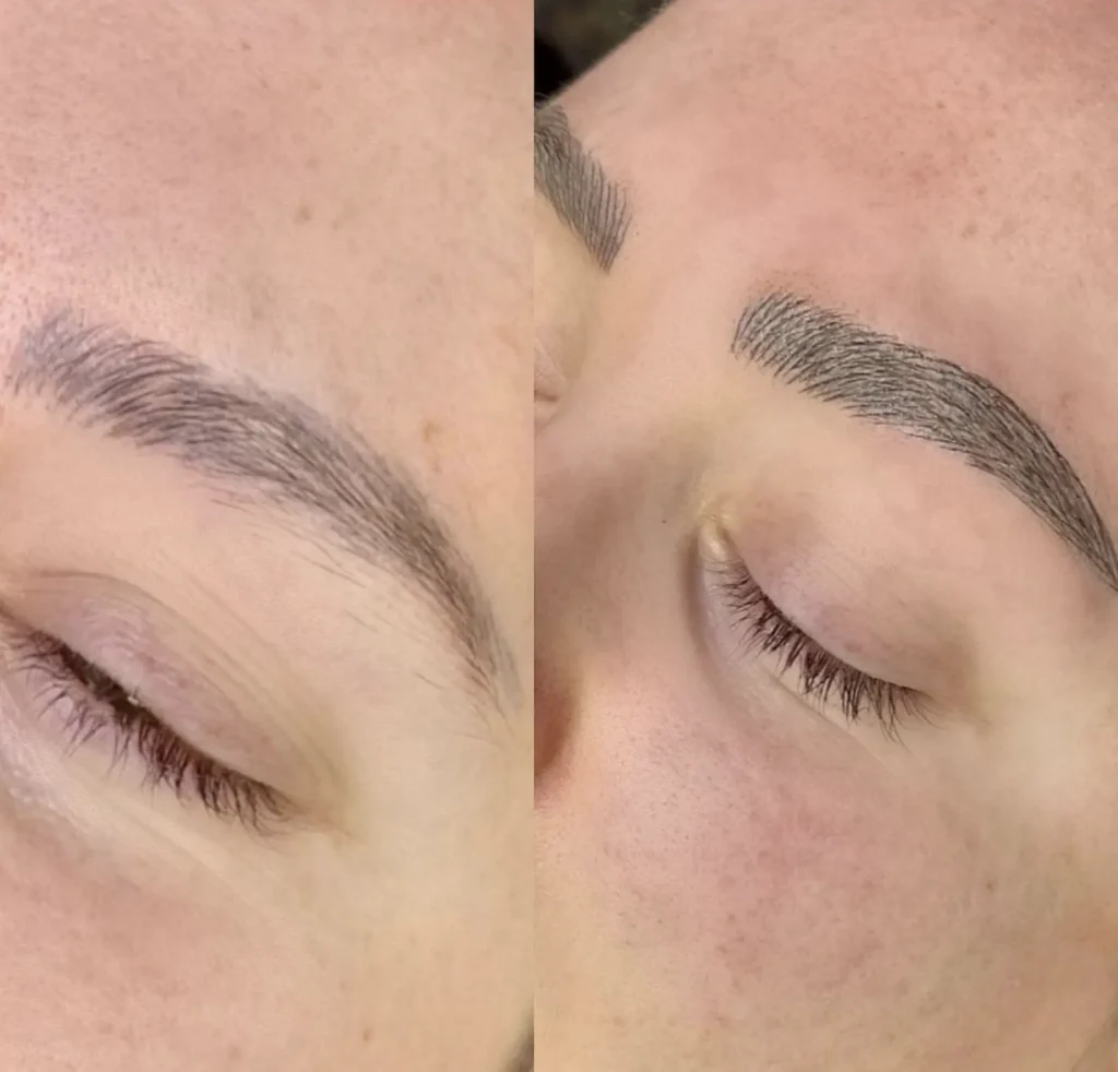 How Long Do Results Really Last