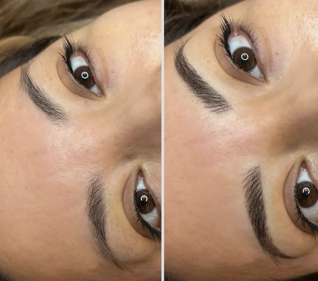 Post Treatment Checklist