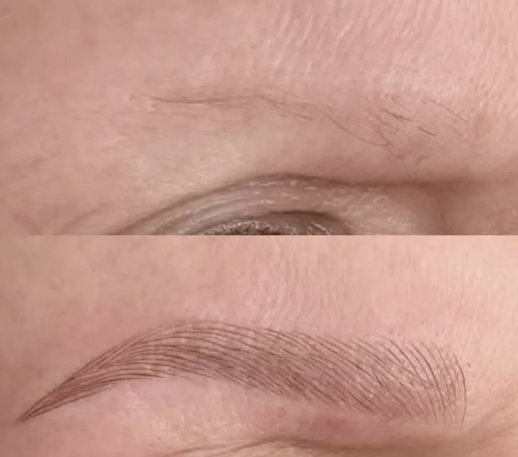 What Can I Use on Healed Brows or Lips