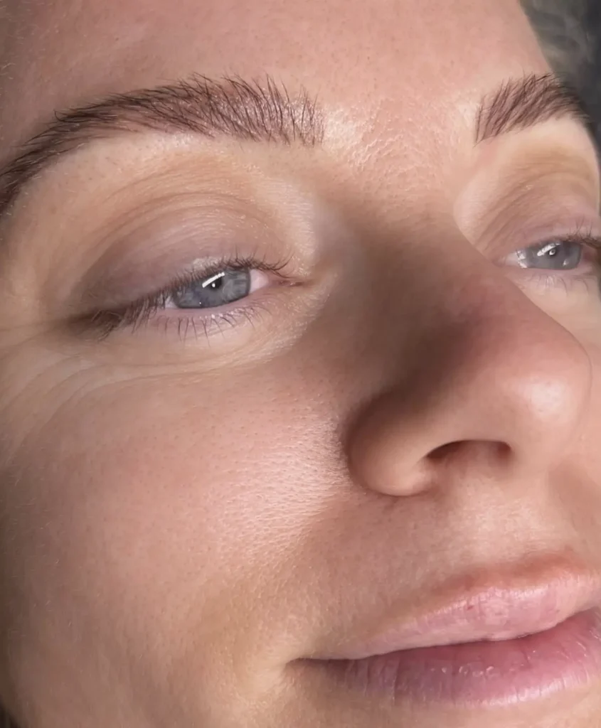 What does standard brow treatment aftercare involve