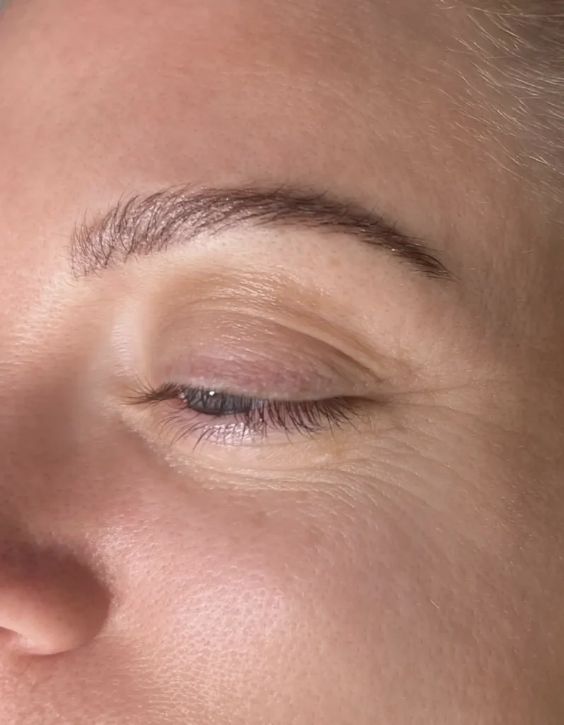 What to Do Before Your Appointment