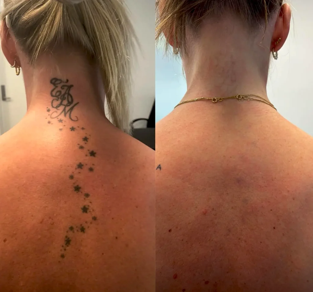 Can You DIY It? Don’t Even Think About It