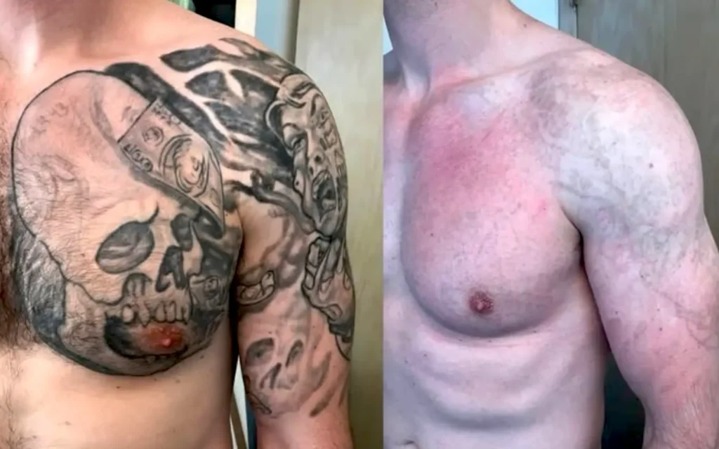 Healing Costs Time and Effort