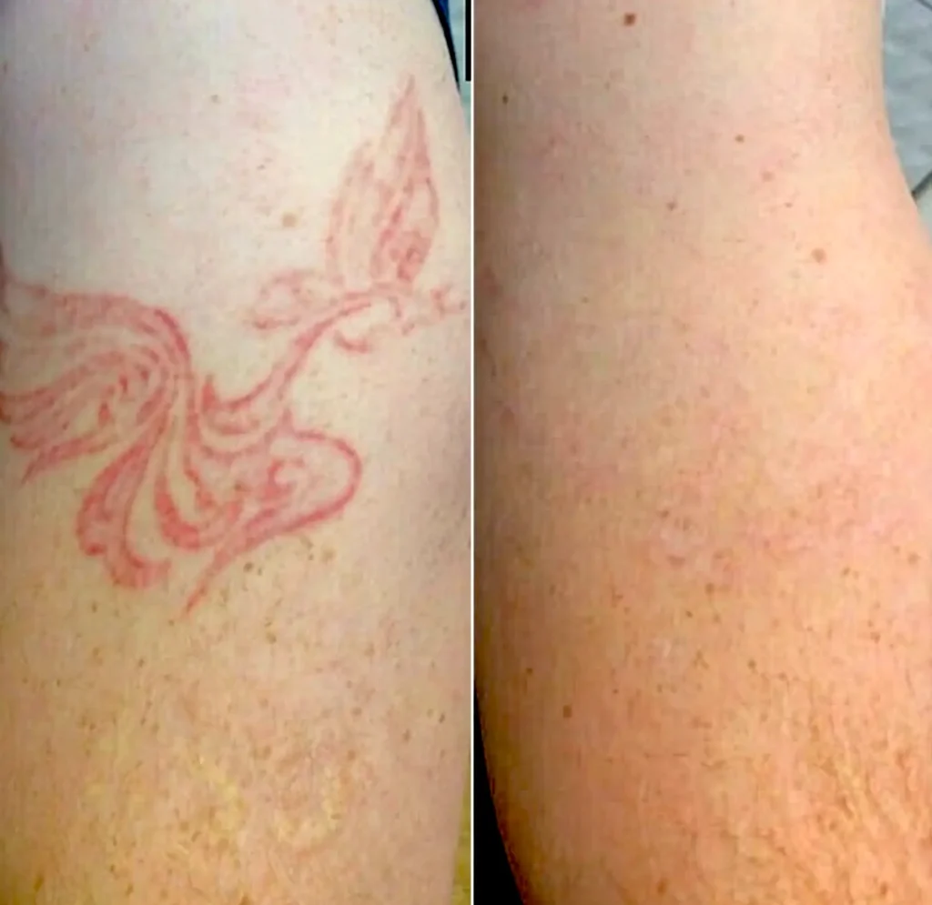 Melbourne Skin Needs