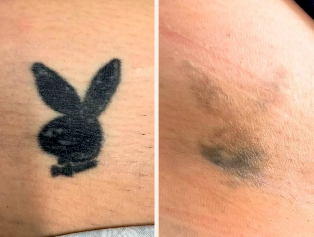 Your Skin Is a Living Organ